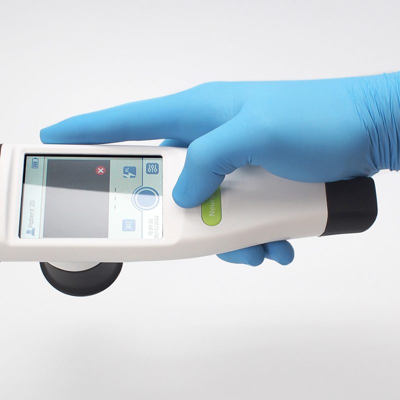IDEACT_IDMED_Pupillomètre_Design